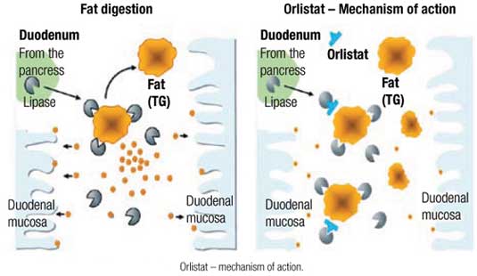 Generic Orlistat Diet Pill