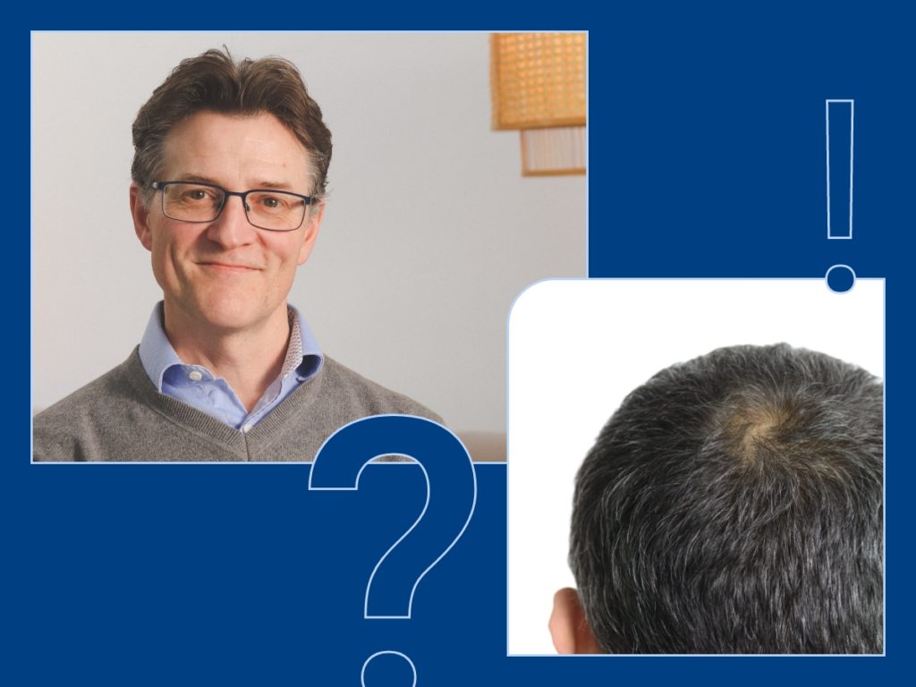 Ask a Doctor: How to stop/prevent hair loss - MedExpress