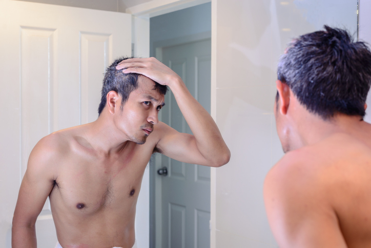 How To Treat Baldness - MedExpress Health Centre